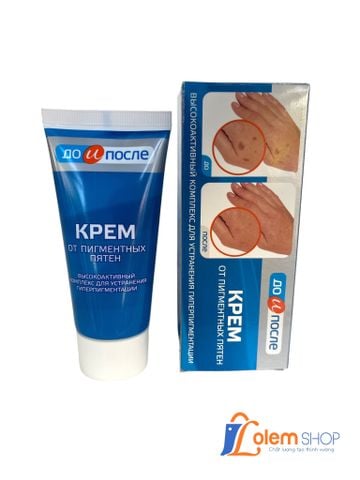 Kem Trị Đồi Mồi Đốm Nâu Da Tay Kpem Hàng Nga 50ml