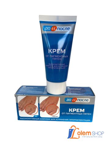 Kem Trị Đồi Mồi Đốm Nâu Da Tay Kpem Hàng Nga 50ml