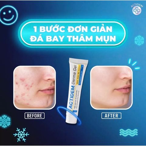 Gel Actidem Derma 40g Giảm Mụn Thâm