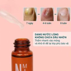 Trị Nấm Móng Fungus Killer 7ml