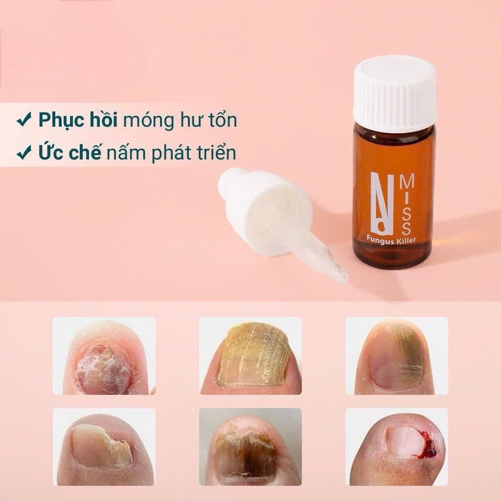 Trị Nấm Móng Fungus Killer 7ml