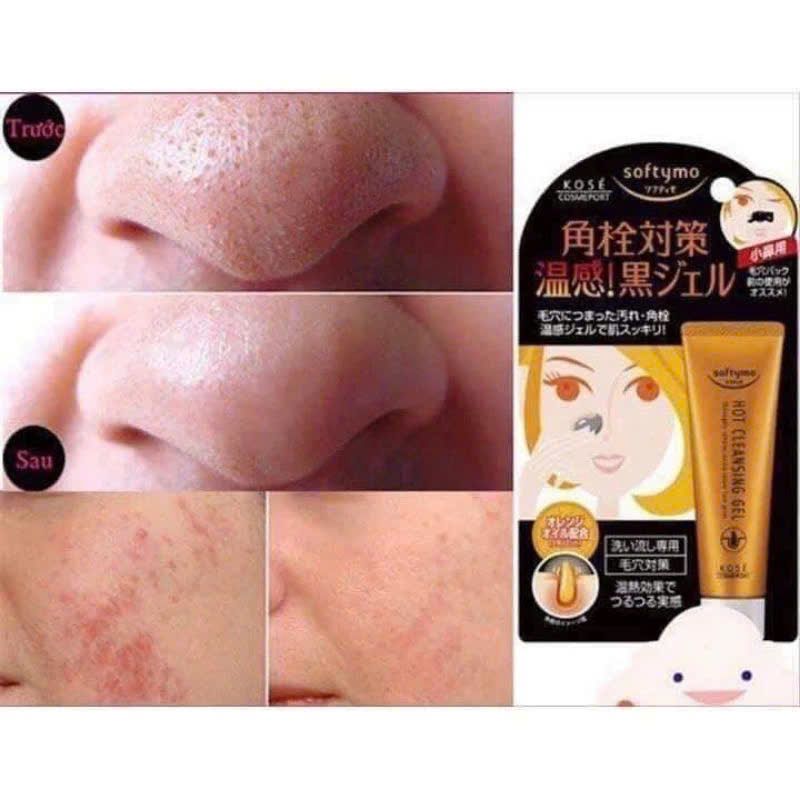 Gel Lột Mụn Kose Hot Cleasing 25g