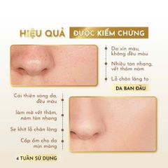Cốt Nám X3 Sicawhite 30g