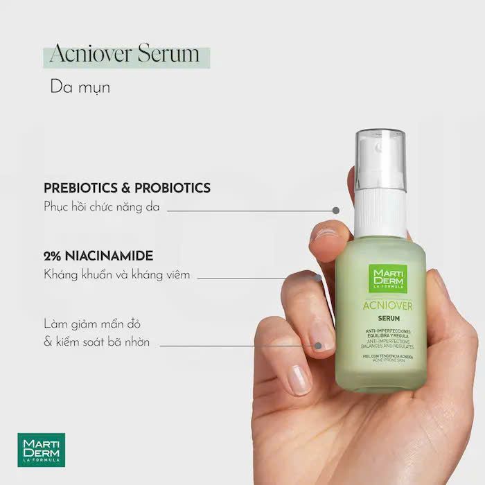 Serum Martiderm 30ml Acniover Giảm Mụn & Kiểm Soát Nhờn
