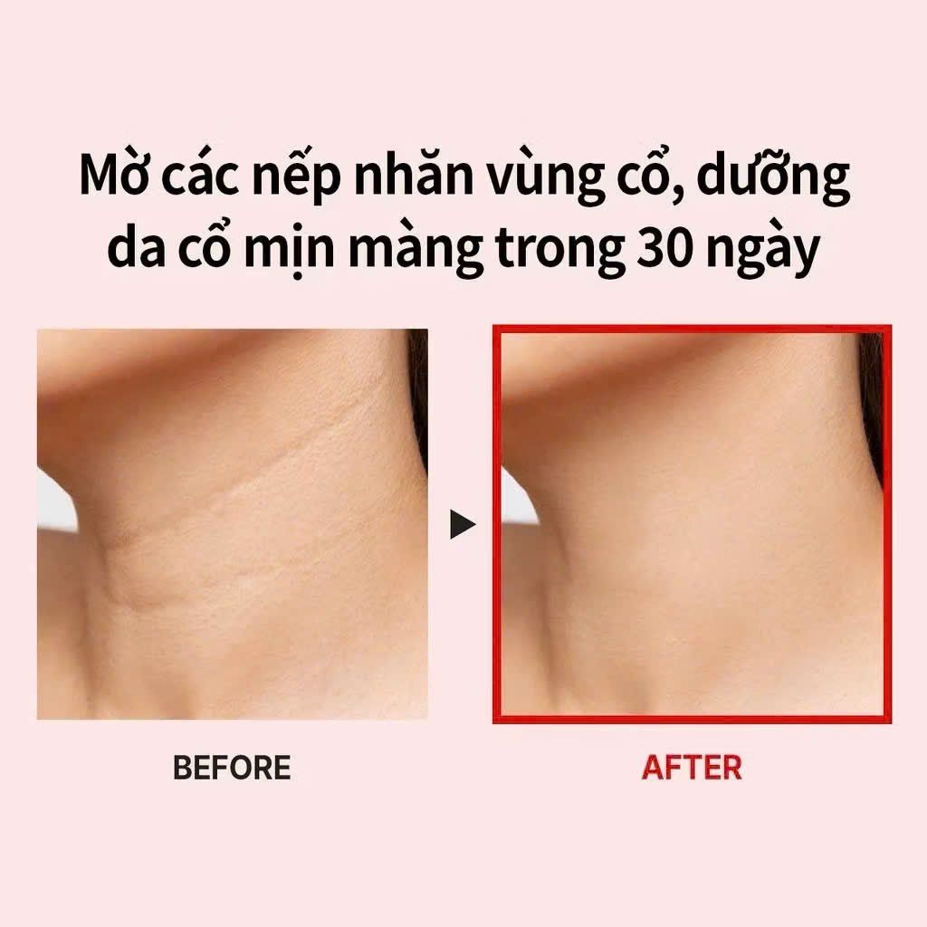 Kem Dưỡng Da Cổ Medi-peel Naite Thread Neck Cream 100ml