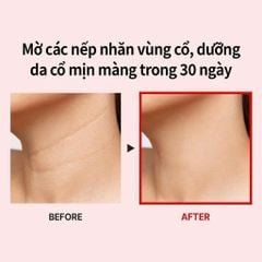 Kem Dưỡng Da Cổ Medi-peel Naite Thread Neck Cream 100ml