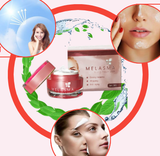  Melasma - Xóa tàn nhan, tự tin tỏa sáng 