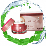  Melasma - Xóa tàn nhan, tự tin tỏa sáng 