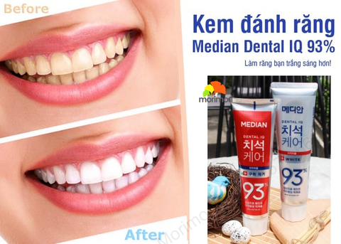 KEM ĐÁNH RĂNG MEDIAN DENTAL IQ 93%