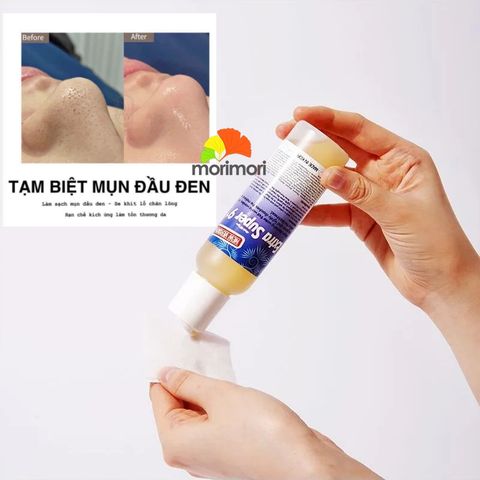 Ủ Mụn Đầu Đen Medi-Peel Extra Super 9 Plus 100ml Hàn Quốc