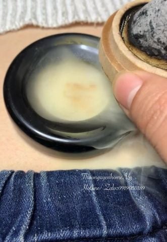  Combo chữa lạnh bụng 