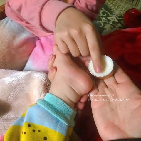  Kem dưỡng làm ấm da 10gram 