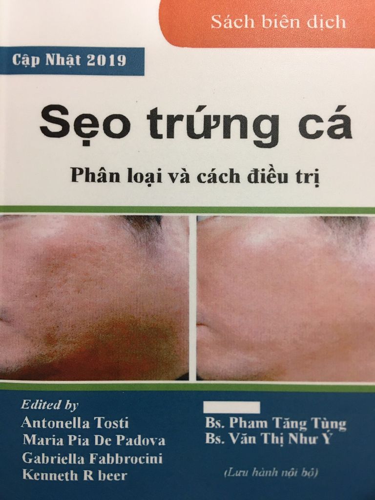 Sẹo trứng cá phân loại và cách điều trị