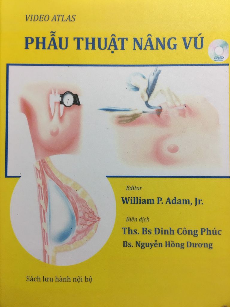 Phẫu thuật nâng Vú