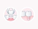  Bàn Chải Đánh Răng Sau Phẫu Thuật GUM Post-Operative – Siêu Mềm, Dịu Nhẹ Cho Nướu Nhạy Cảm 
