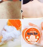 005. Bánh xà phòng trị mụn lưng Label Young Shocking Body Bar