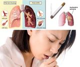 Viên Hỗ Trợ Thải Độc Phổi Healthy Care Original Lung Detox hộp 180 viên của Úc ( mẩu mới ).