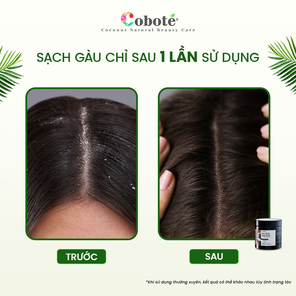 Tẩy tế bào chết da đầu - Hair & Scalp Detox Scrub