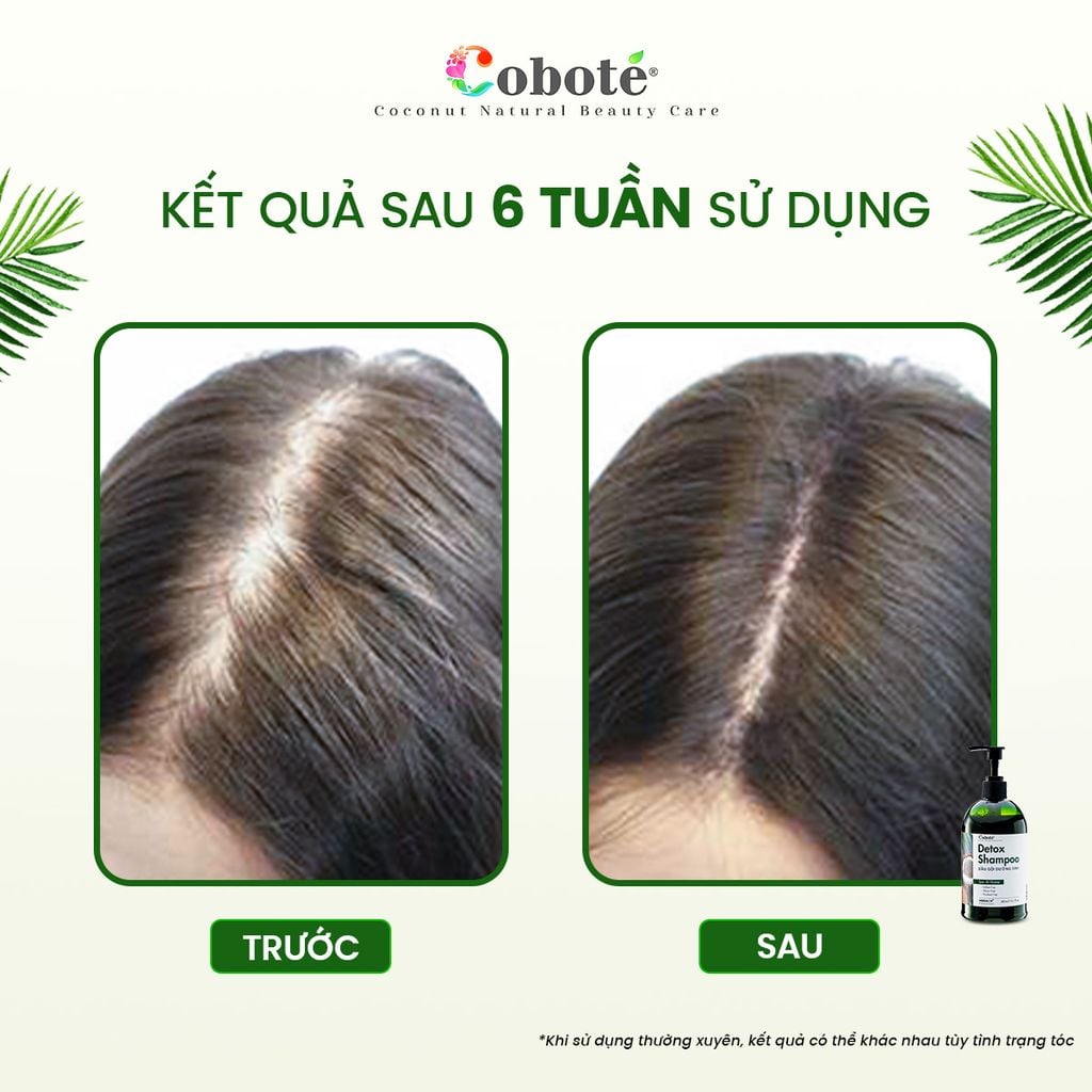 Dầu gội dưỡng sinh - Detox Shampoo