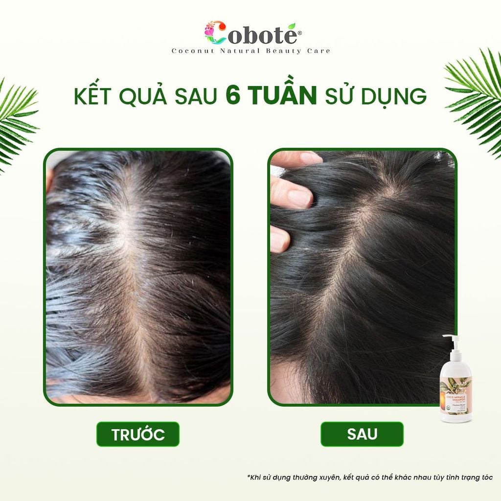 Dầu gội dừa - Coco Miracle Shampoo 480ml