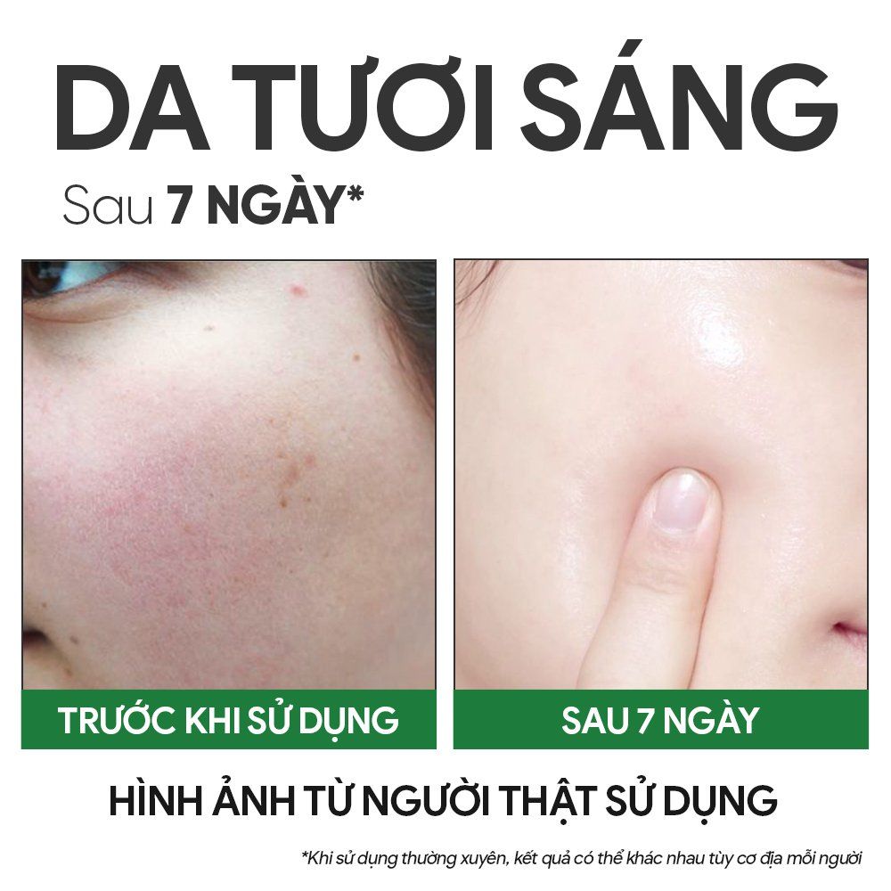 Tinh Chất Dưỡng Da Tươi Trẻ - Youthful Glow Face Serum 30ml