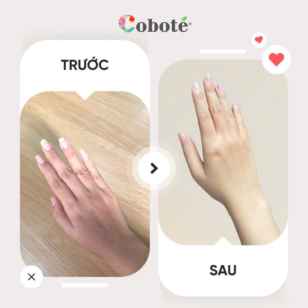 Kem Dưỡng Da Tay Và Móng - Coco Miracle Hand Nutrition 20g