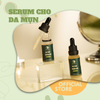 Serum mụn 20g (Acne Serum)