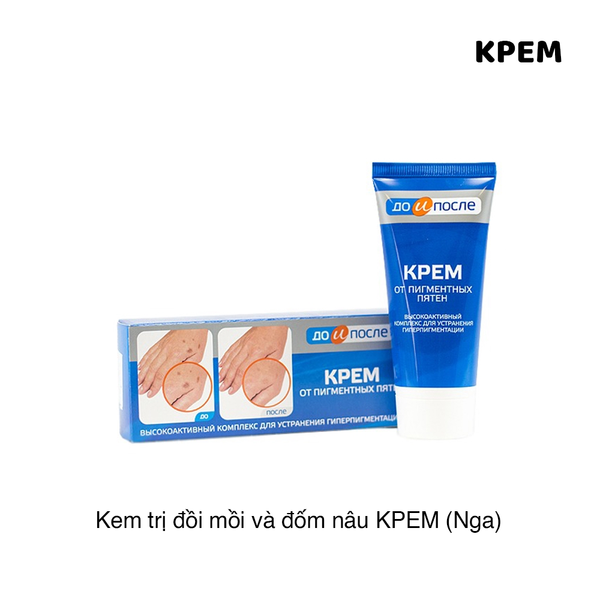 KEM TRỊ ĐỒI MỒI VÀ ĐỐM NÂU DA TAY KPEM