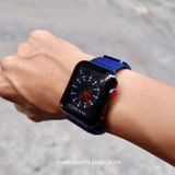 Dây đeo Apple Watch Milan Loop