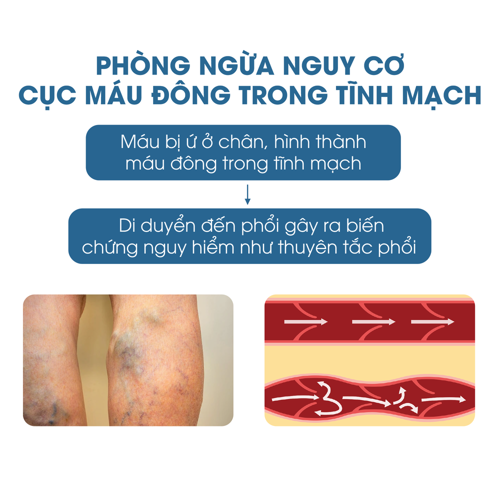 Mua gối kê chân ở đâu?