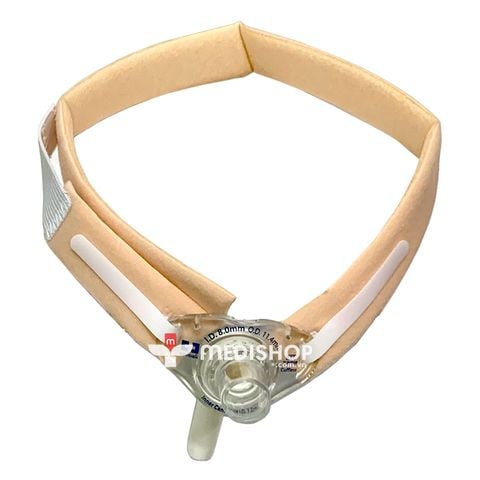 day dai co dinh ong mo khi quan khai khi quan