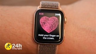Cách đo điện tâm đồ (ECG) trên Apple Watch chính thức tại Việt Nam, bất cứ ai cũng có thể đo được