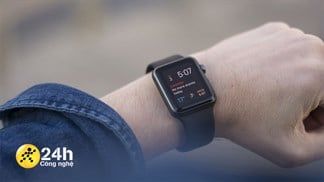Mừng bão sale đại lễ, Apple Watch S3 GPS 38mm giảm bật gốc đến bạc triệu, giá rẻ hiếm có khó tìm, đừng bỏ lỡ