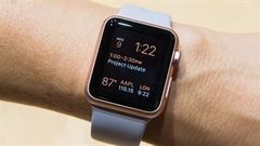  Đồng hồ thông minh Apple Watch Series 6 được liệt kê là từ khóa trong video giới thiệu sự kiện vào ngày 15/9 của Apple 