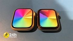  Đặt cạnh Apple Watch S7 và S6: Màn hình lớn hơn thực sự, viền mỏng gấp đôi thế hệ trước, mọi người gom lúa mua thôi nào! 