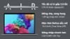 Laptop Apple MacBook Air M1 2020 8GB/256GB/7-core GPU (MGN93SA/A)