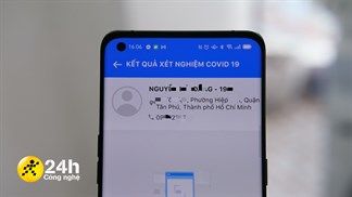 Sở Y tế TP.HCM bắt đầu trả kết quả xét nhiệm Covid-19 bằng QR Code, người dân chỉ cần tải app để nhận thông tin