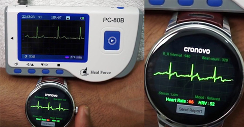 ECG là gì? Dùng để làm gì? Có trên các thiết bị nào?