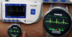  ECG là gì? Dùng để làm gì? Có trên các thiết bị nào? 