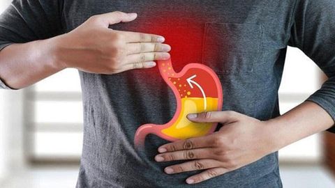 Trào ngược dạ dày nên ăn gì? Cách làm giảm trào ngược dạ dày từ thực phẩm