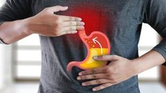  Trào ngược dạ dày nên ăn gì? Cách làm giảm trào ngược dạ dày từ thực phẩm 