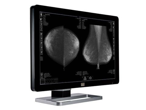Màn Hình Y Tế Barco® Coronis Fusion MDCG-10130
