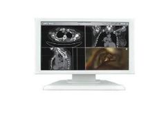  Màn hình y tế BIO-X Medical Grade Monitor 19 Inch 
