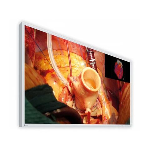 Màn Hình Y Tế EIZO CuratOR EX4342-3D