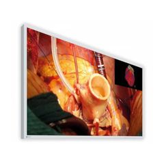  Màn Hình Y Tế EIZO CuratOR EX4342-3D 