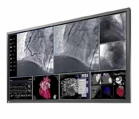 Màn Hình Y Tế EIZO CuratOR L580W