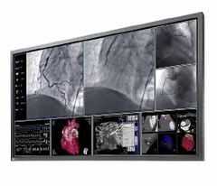  Màn Hình Y Tế EIZO CuratOR L580W 