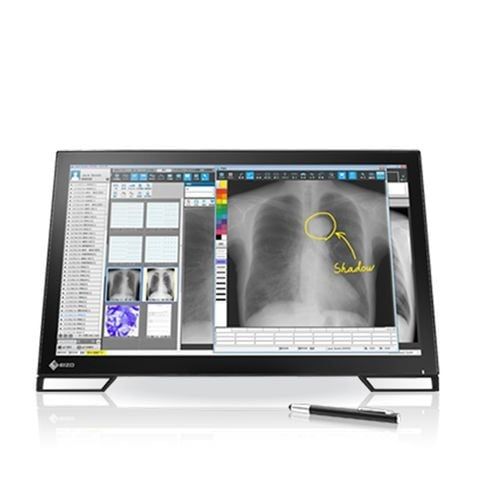 Màn Hình Y Tế EIZO RadiForce  MS236WT-A