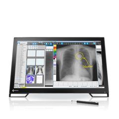  Màn Hình Y Tế EIZO RadiForce  MS236WT-A 