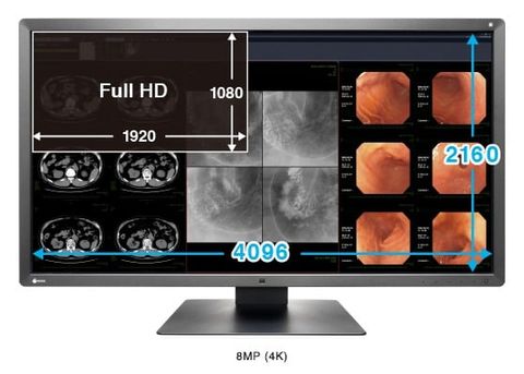 Màn Hình Y Tế EIZO RadiForce® MX315W